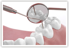 zähne © Jessica Schindler